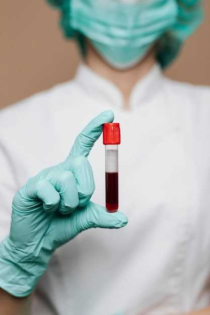 Значение PCT в анализе крови у женщин
