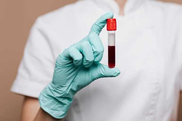 Зачем нужно проводить анализ крови на фолиевую кислоту?