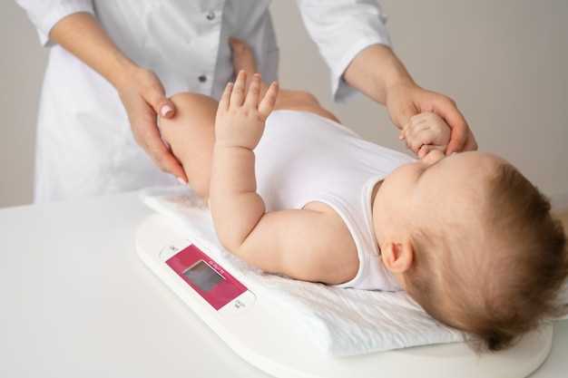 Эффективные методы лечения диатеза у младенцев