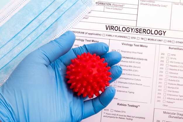 Как выявить наличие ВИЧ: основные методы диагностики