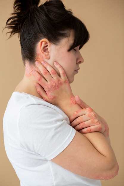 Признаки и симптомы воспаления лимфоузлов на шее