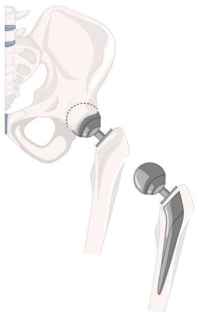 Основные компоненты коленного сустава