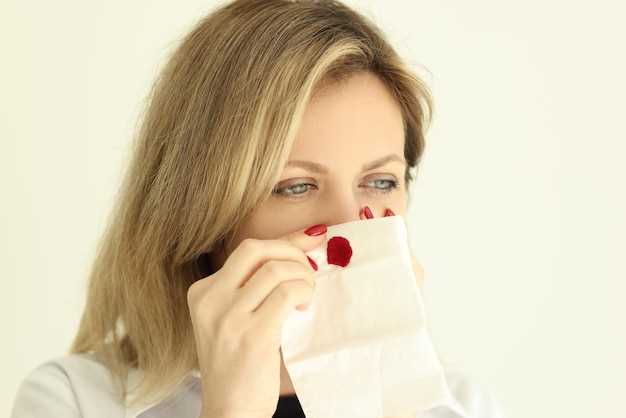 Кровотечение из носа у взрослого: первая помощь